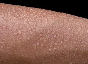 Human skin sweating after the use of an infrared sauna